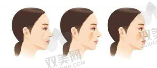 热门项目解读