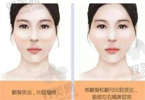 乔雅登丰颜：高端品质的深度除皱之选