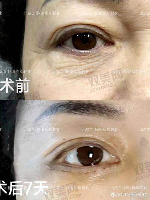 【南宁柏琳悦美医疗美容医院怎么样】