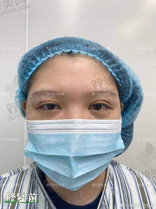 隆胸价格曝光表｜你的钱包准备好了吗？