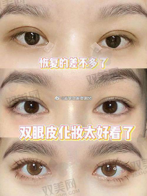结语：闭眼无痕不是玄学，“妈生眼”真能靠刘志刚来实现
