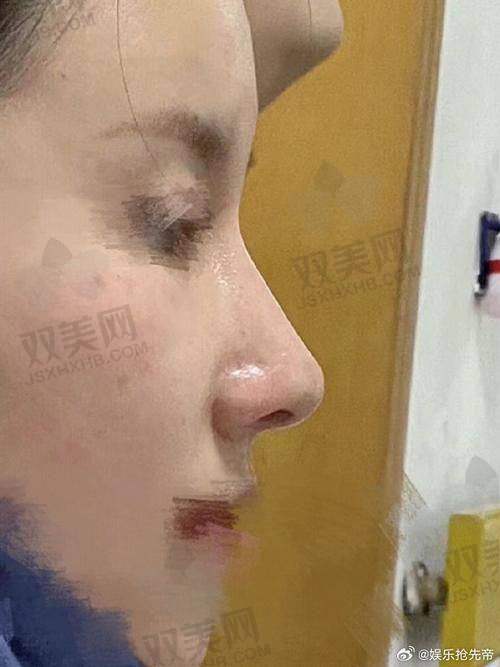 结语：青浦虽小，医美能量大！