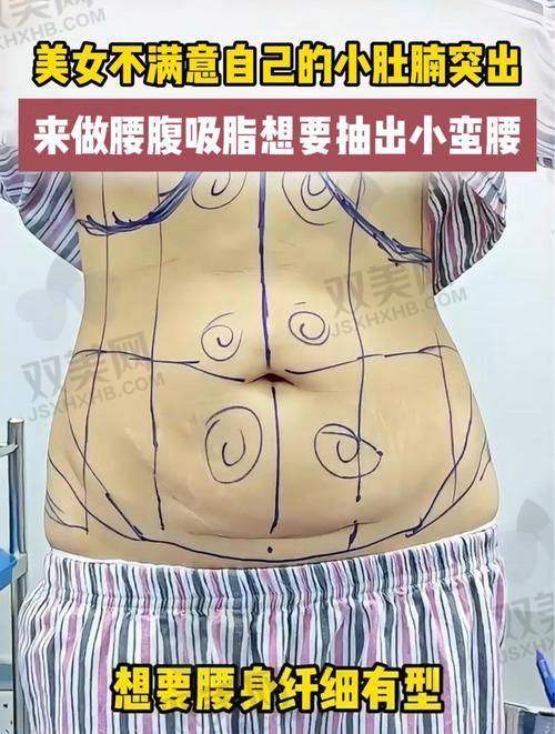 结语｜想平坦腹部，不只靠勇气，更要靠靠谱医生！