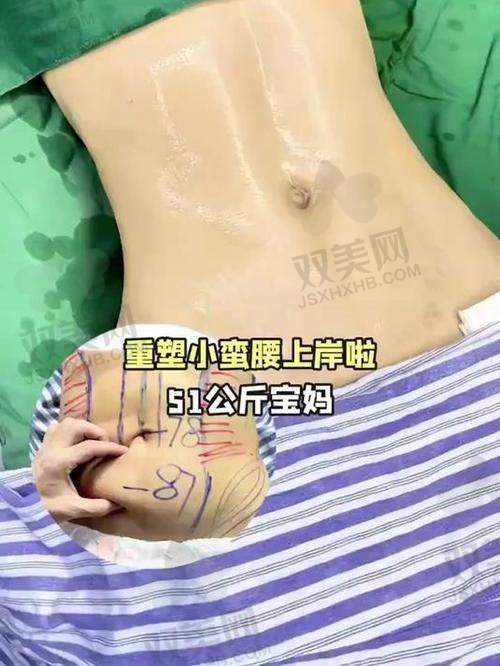 重庆腹壁成型医院哪家好？重庆腹壁成型医院TOP10推荐