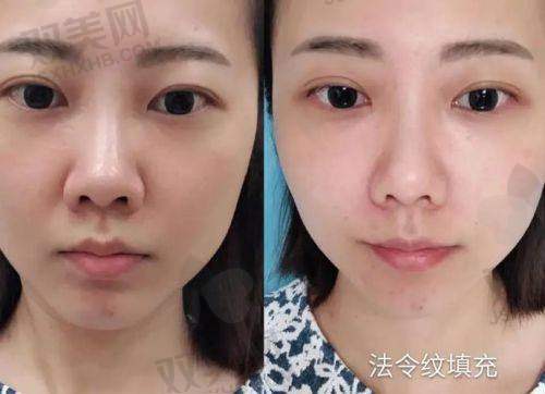 【南宁爱思特医疗美容医院是正规的吗】