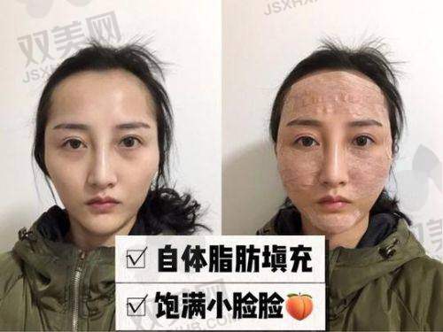 【南宁爱思特医疗美容医院擅长什么项目】