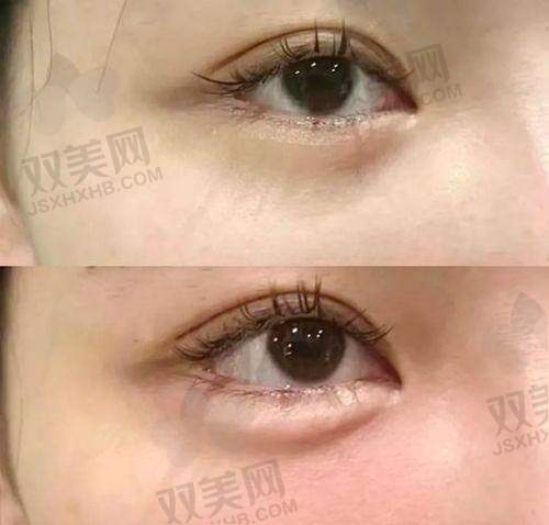 【南宁桂美汇医疗美容诊所是私立还是公办】