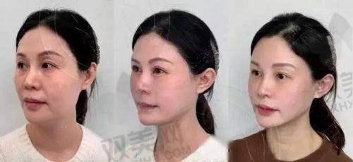 【揭阳和美医疗美容门诊部地址及乘车路线】