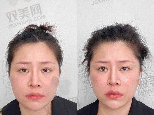 【普宁安琪医疗美容医院技术特点】