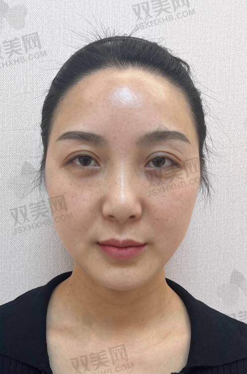 【普宁安琪医疗美容医院地址及乘车路线】