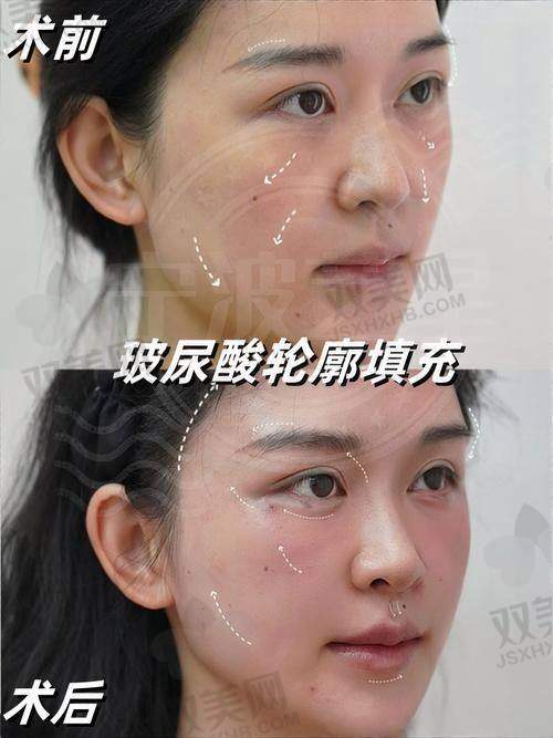 总结