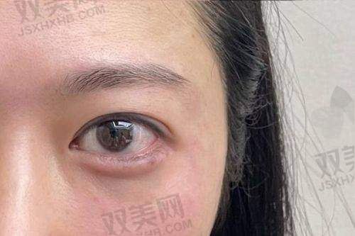 总结