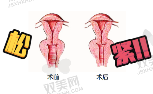 【普宁安琪医疗美容医院擅长什么项目】