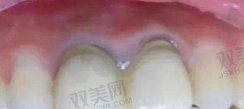 市场供需关系对价格的影响