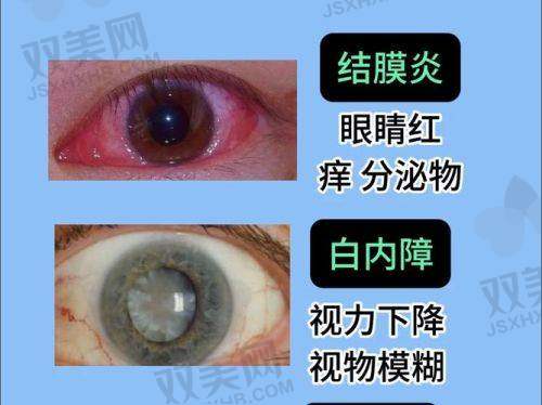 【华北理工大学附属医院眼科营业时间是什么时候】
