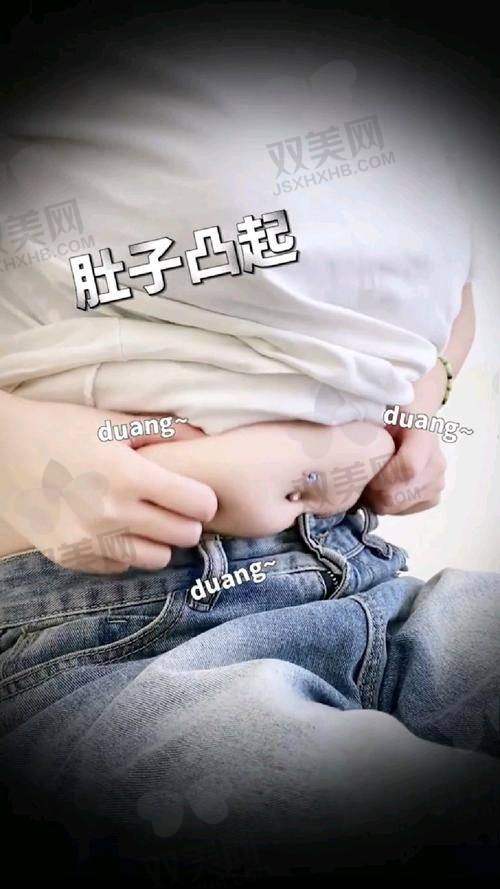 重庆腹壁成型术价格参考