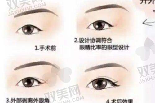 【钦州赫珀医疗美容医院是私立还是公办】
