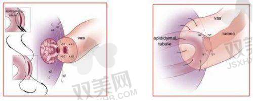 【玉林时光医疗美容医院地址】