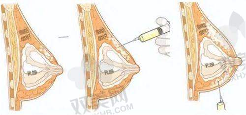 【北海美诺医疗美容诊所技术特点】