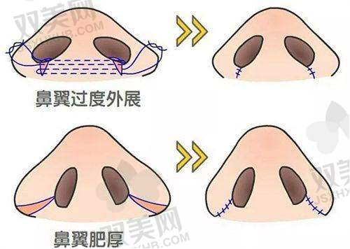 【钦州赫珀医疗美容医院技术特点】