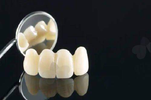 六、为什么说曙康口腔的种植牙价格“真香”？