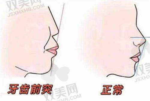 二、上海曙康口腔种植牙价格全集曝光：单颗价格篇