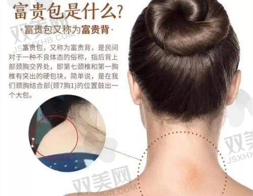 【玉林悦目医疗美容诊所是正规的吗】