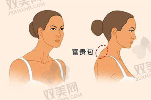 【钦州赫珀医疗美容医院怎么样】