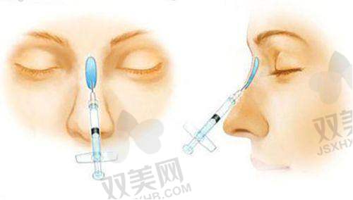 【海口焕颜医疗美容医院是私立还是公办】