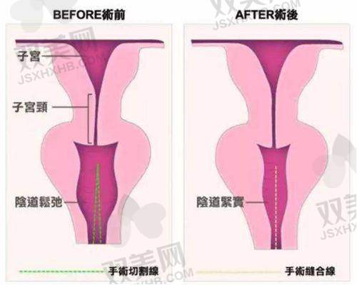 【百色华美医疗美容门诊部地址】