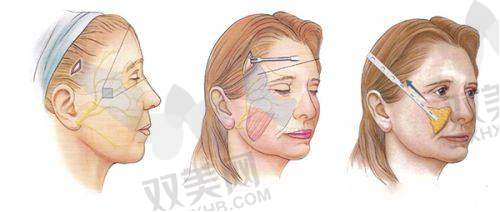 【百色华美医疗美容门诊部怎么样】