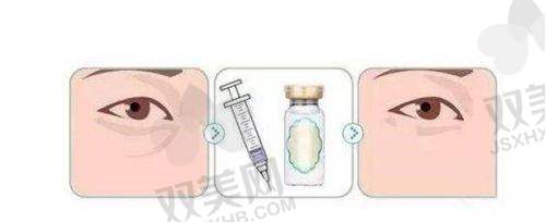 【海南华大医疗美容门诊部是正规的吗】