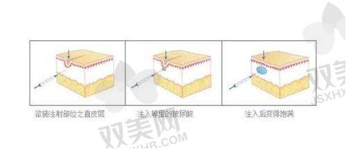 【海口焕颜医疗美容医院怎么样】