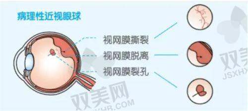 【秦皇岛市第一医院眼科是私立还是公办】