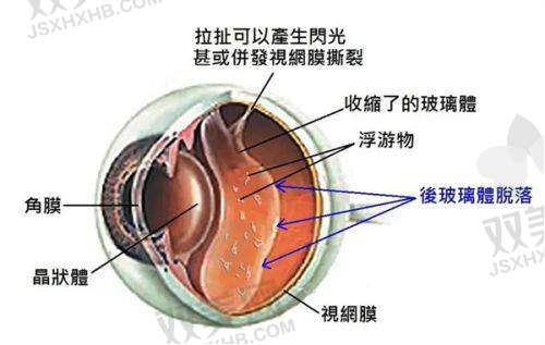 【秦皇岛市第二医院眼科怎么样】