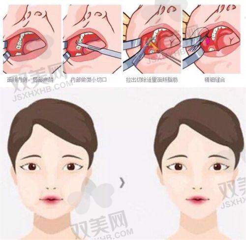【玉林时光医疗美容医院电话号码是多少】