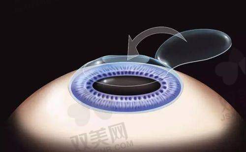 【秦皇岛市第二医院眼科营业时间是什么时候】