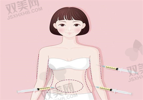 2025美莱整形吸脂价格表：西安大腿吸脂3750起，郑州5G光雕3W送护理