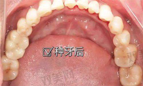 末尾总结一句话：尤旦口腔，为上海人看牙撑起稳稳的牙套！