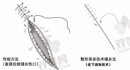 欣德美和乔雅登的价格对比