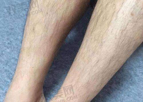 【成都丝恒植发医院营业时间是什么时候】