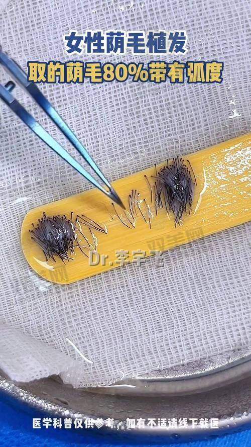 【成都丝恒植发医院怎么预约挂号】