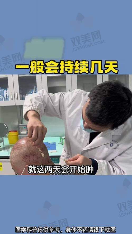 【成都丝缘植发医院擅长什么项目】