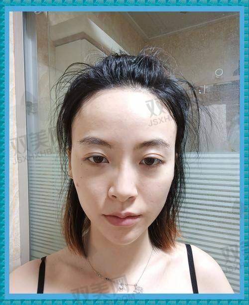凹陷填充精华的功效探讨