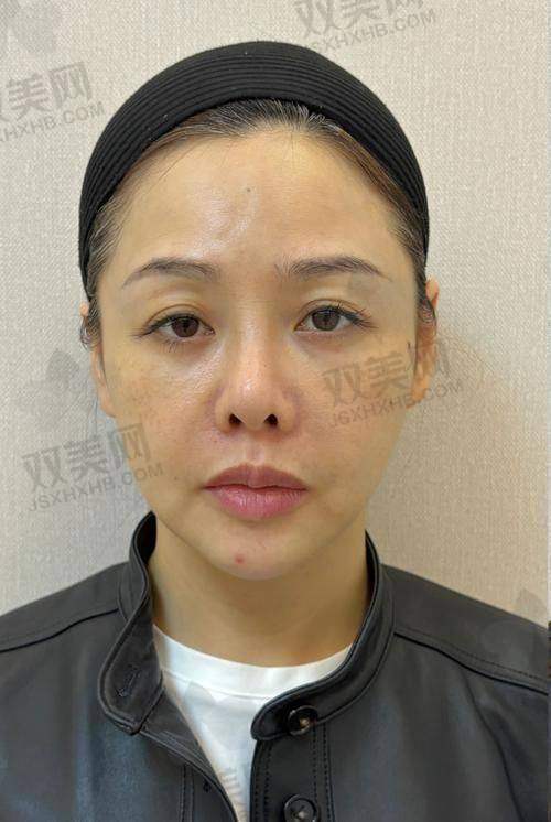 【成都高新米兰柏羽医疗美容医院怎么预约挂号】