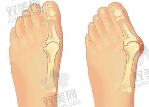 杭州艺星整形项目价格