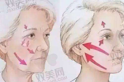成功实例的参考