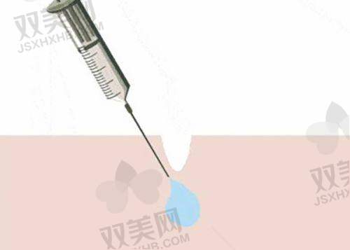 王志强医生的眼修复优势