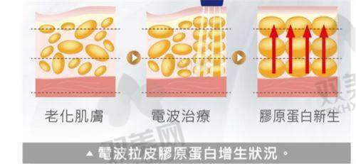 超体Transplus的型号解析