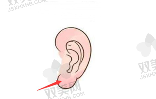 超体Transplus与传统隆鼻材料的对比